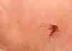 MURDERED•MOSQUITO logo