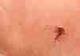 MURDERED•MOSQUITO logo